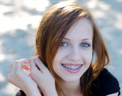 How Long Does Orthodontic Treatment Take? Key Factors Explained 